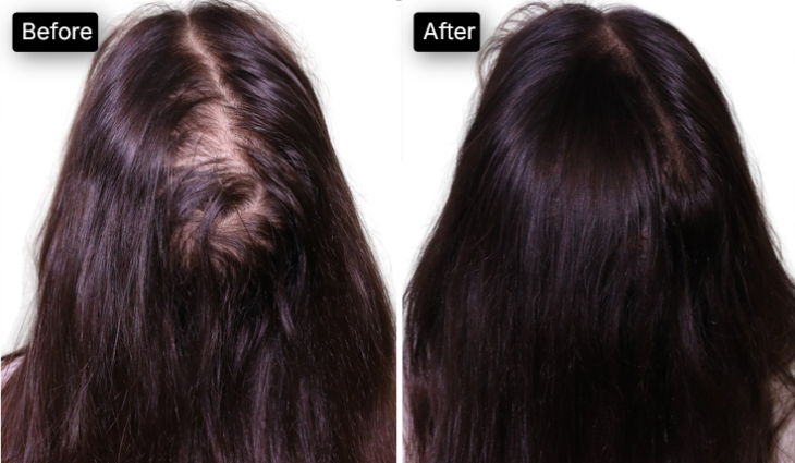 before after 1